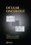 Ocular Oncology cover