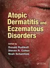 Atopic Dermatitis and Eczematous Disorders cover