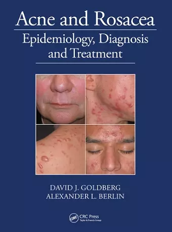 Acne and Rosacea cover