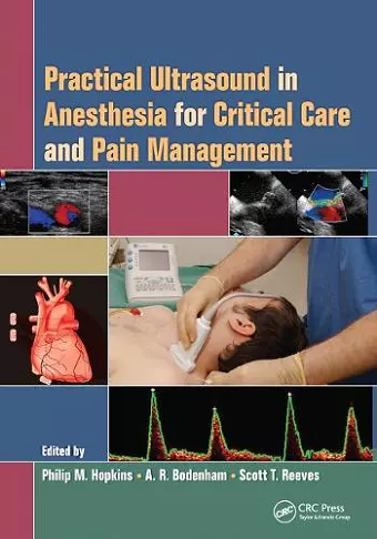 Practical Ultrasound in Anesthesia for Critical Care and Pain Management cover