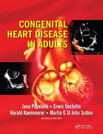 Congenital Heart Disease in Adults cover