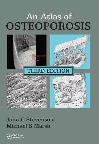 An Atlas of Osteoporosis cover