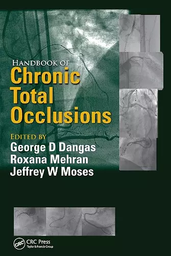 Handbook of Chronic Total Occlusions cover