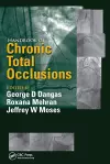 Handbook of Chronic Total Occlusions cover