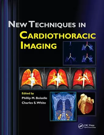 New Techniques in Cardiothoracic Imaging cover