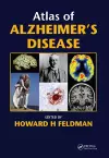 Atlas of Alzheimer's Disease cover