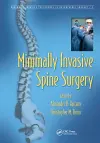 Minimally Invasive Spine Surgery cover