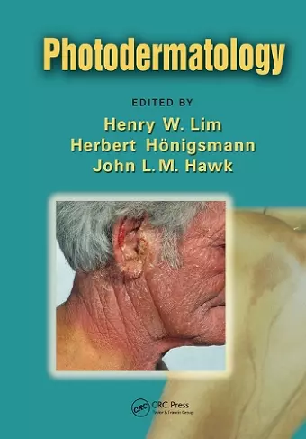 Photodermatology cover