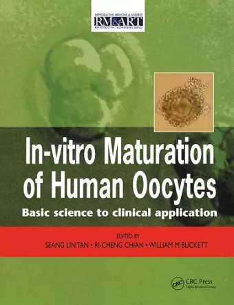 In Vitro Maturation of Human Oocytes cover