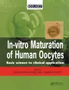 In Vitro Maturation of Human Oocytes cover