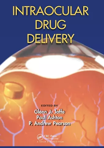 Intraocular Drug Delivery cover