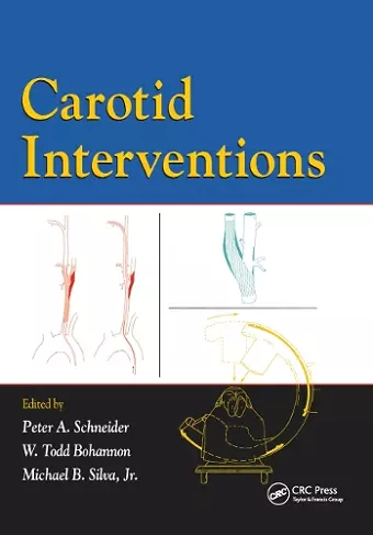 Carotid Interventions cover