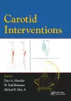 Carotid Interventions cover