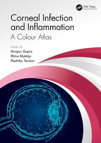 Corneal Infection and Inflammation cover