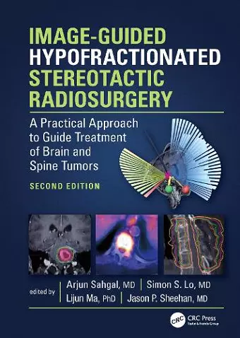 Image-Guided Hypofractionated Stereotactic Radiosurgery cover