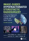 Image-Guided Hypofractionated Stereotactic Radiosurgery cover