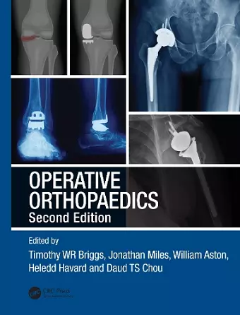 Operative Orthopaedics cover