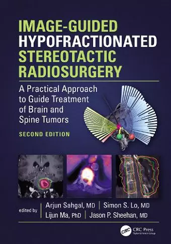 Image-Guided Hypofractionated Stereotactic Radiosurgery cover