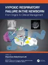 Hypoxic Respiratory Failure in the Newborn cover