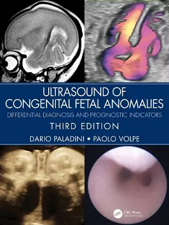 Ultrasound of Congenital Fetal Anomalies cover