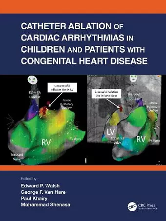 Catheter Ablation of Cardiac Arrhythmias in Children and Patients with Congenital Heart Disease cover