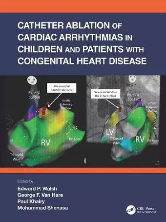 Catheter Ablation of Cardiac Arrhythmias in Children and Patients with Congenital Heart Disease cover