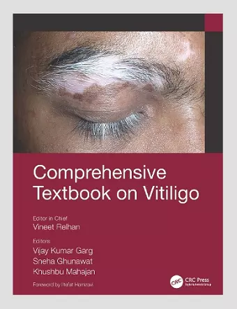 Comprehensive Textbook on Vitiligo cover