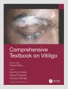 Comprehensive Textbook on Vitiligo cover