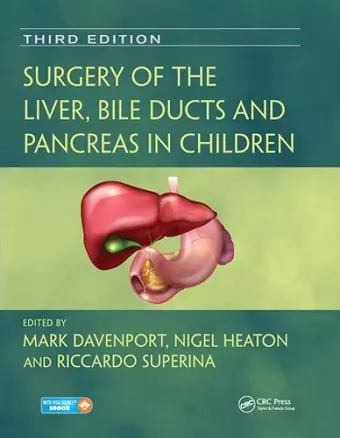 Surgery of the Liver, Bile Ducts and Pancreas in Children cover