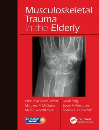 Musculoskeletal Trauma in the Elderly cover