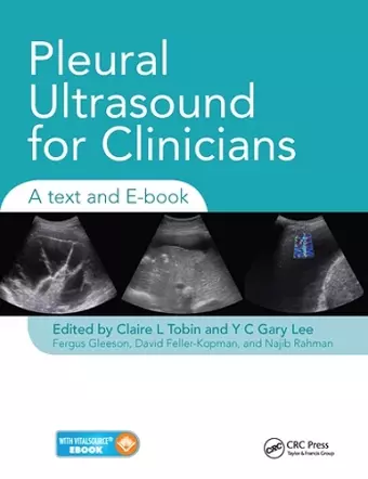 Pleural Ultrasound for Clinicians cover