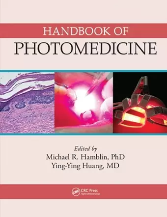 Handbook of Photomedicine cover