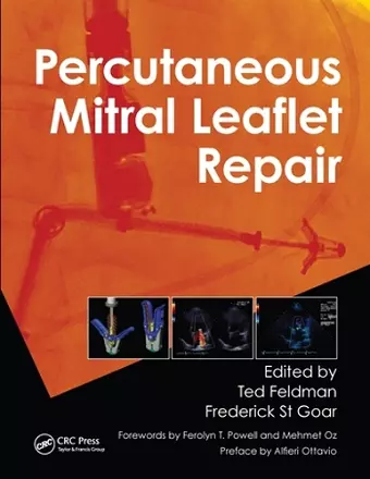 Percutaneous Mitral Leaflet Repair cover