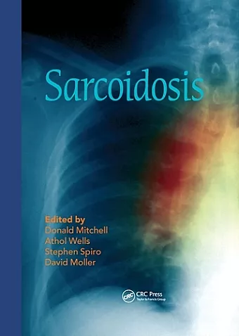 Sarcoidosis cover