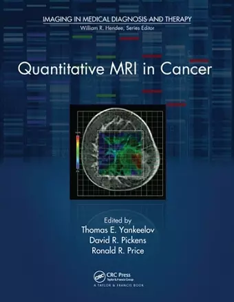 Quantitative MRI in Cancer cover