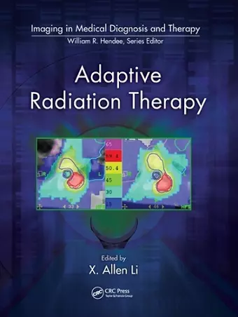 Adaptive Radiation Therapy cover