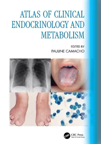 Atlas of Clinical Endocrinology and Metabolism cover