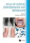 Atlas of Clinical Endocrinology and Metabolism cover