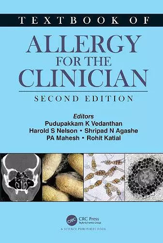 Textbook of Allergy for the Clinician cover