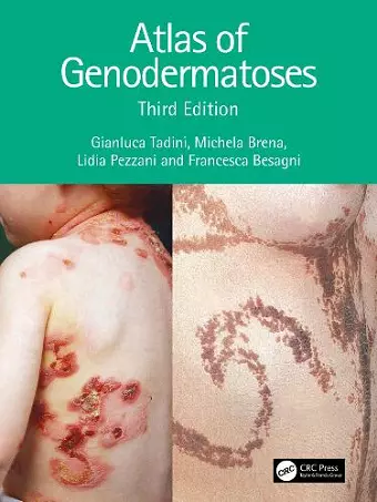 Atlas of Genodermatoses cover