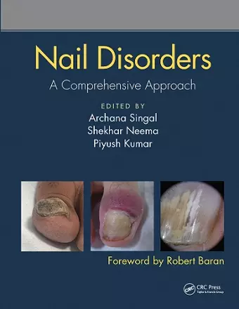 Nail Disorders cover