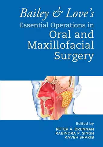 Bailey & Love's Essential Operations in Oral & Maxillofacial Surgery cover