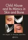 Child Abuse and its Mimics in Skin and Bone cover