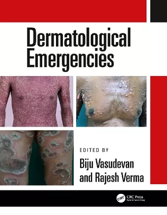 Dermatological Emergencies cover