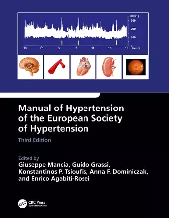 Manual of Hypertension of the European Society of Hypertension, Third Edition cover