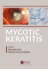 Mycotic Keratitis cover