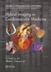 Hybrid Imaging in Cardiovascular Medicine cover