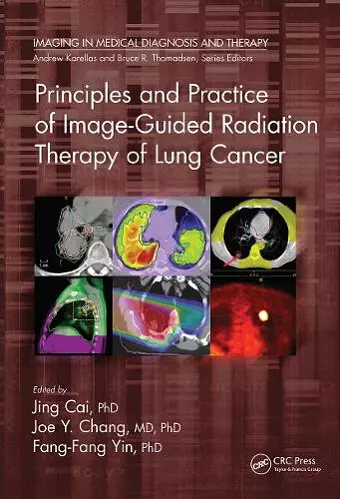 Principles and Practice of Image-Guided Radiation Therapy of Lung Cancer cover