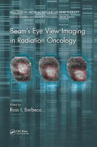 Beam's Eye View Imaging in Radiation Oncology cover