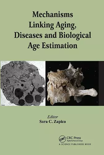 Mechanisms Linking Aging, Diseases and Biological Age Estimation cover